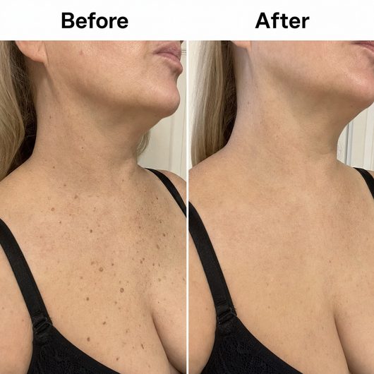 Glycolic Body Stick